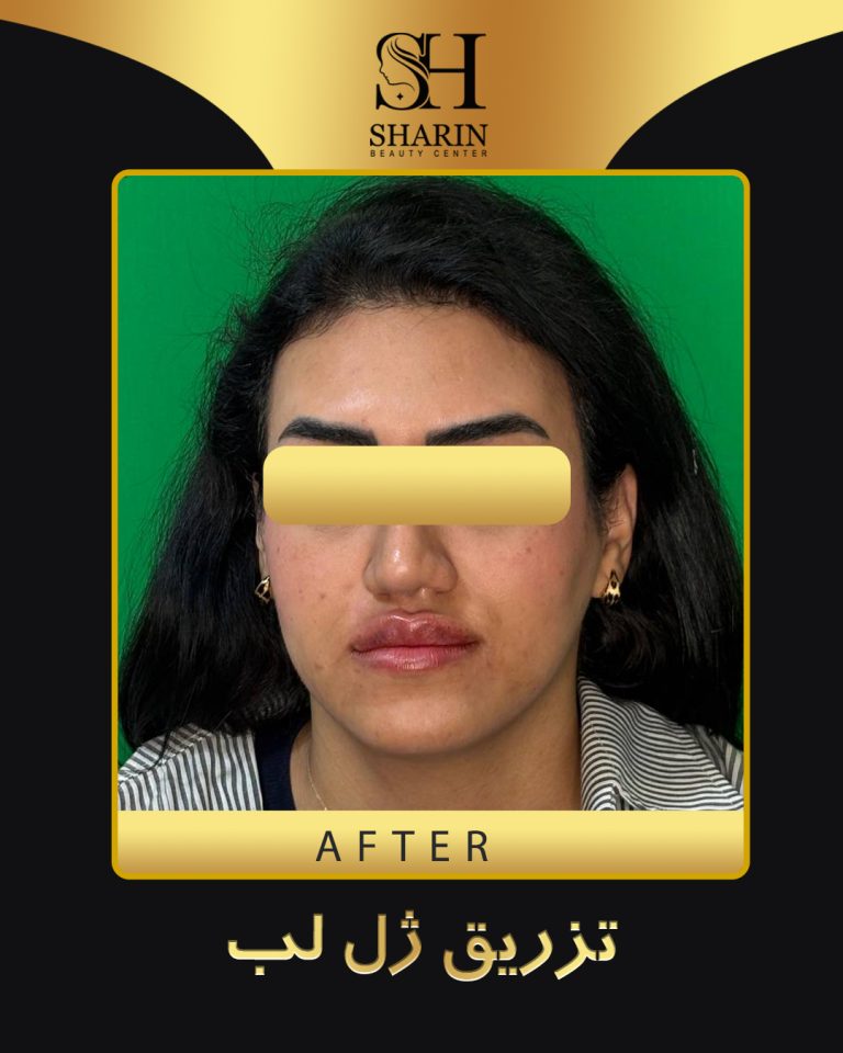 slid sharin1.1