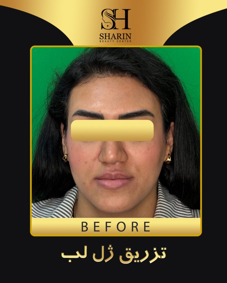 slid sharin1.2