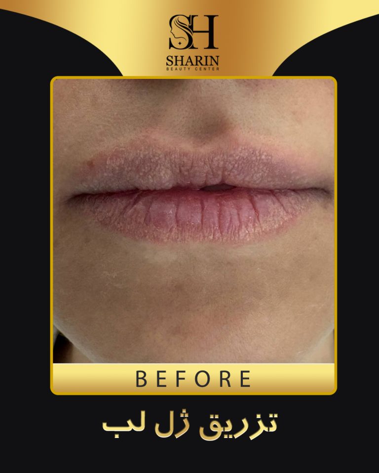 slid sharin2
