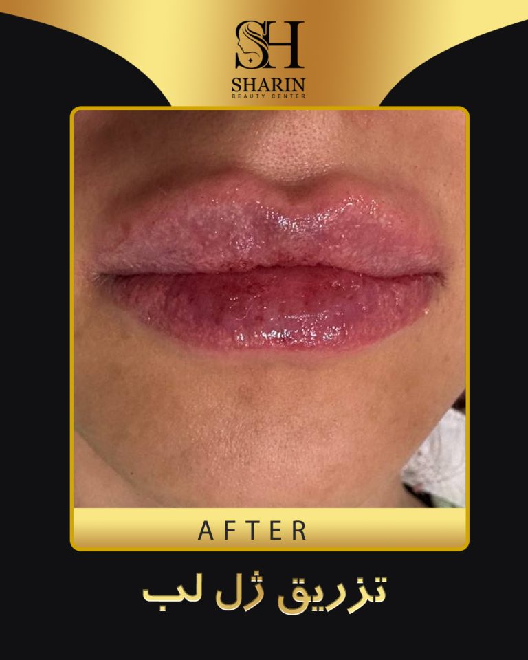 slid sharin2.1