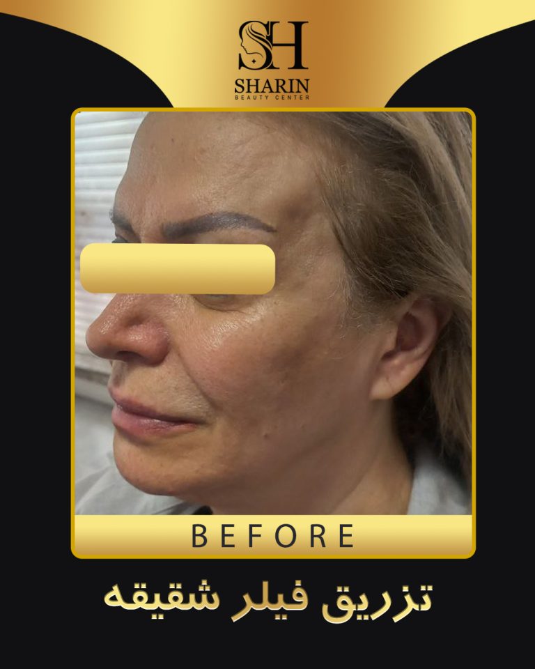 slid sharin3