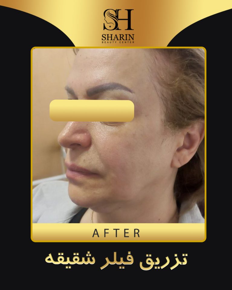 slid sharin3.3