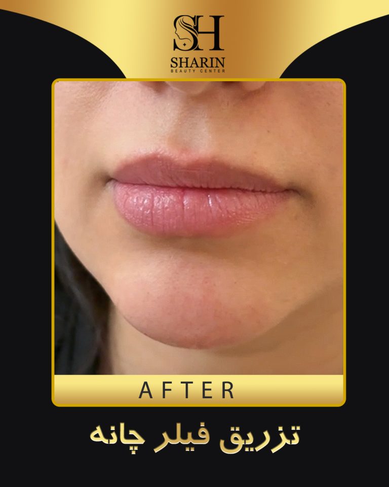slid sharin4.2