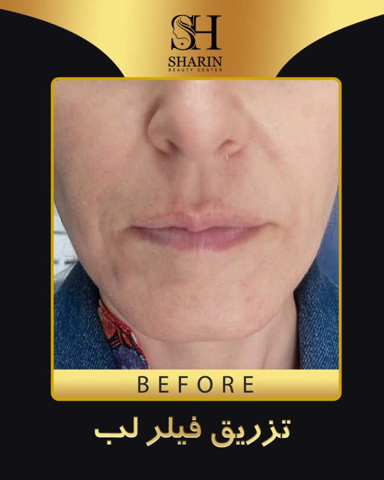 slid sharin5