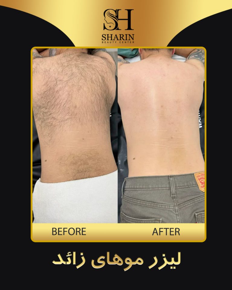 slid sharin6.2