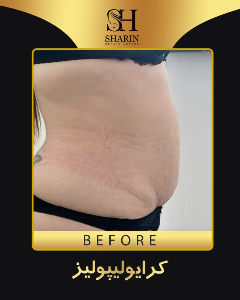 slid sharin9