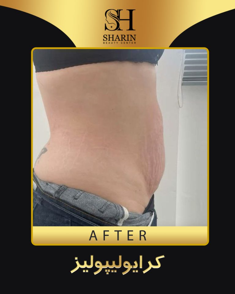 slid sharin9.1