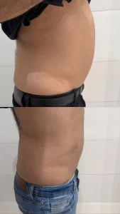 خدمات لاغری در کلینیک شارین