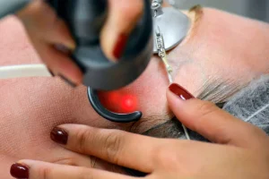 کلینیک شارین لیزر موهای زائد